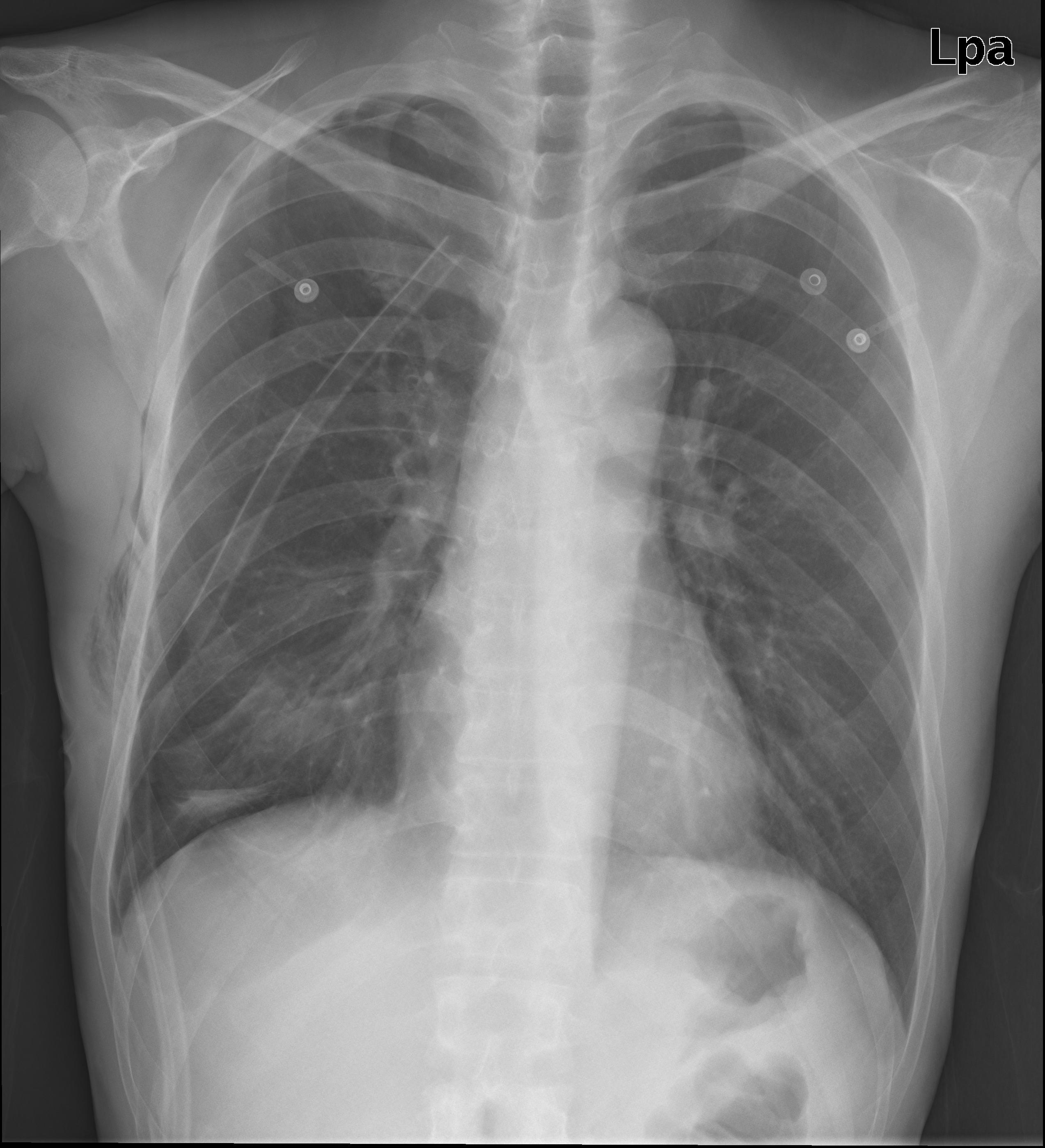 CHEST.jpg