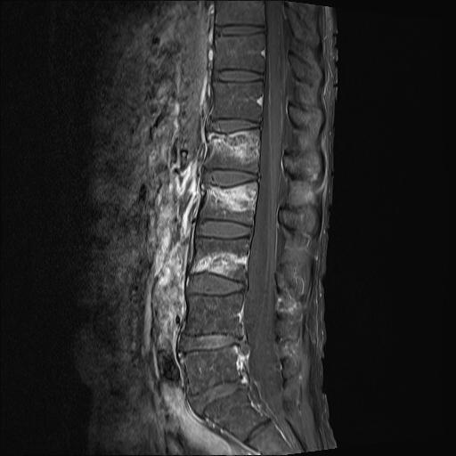 MRI-L-1.jpg