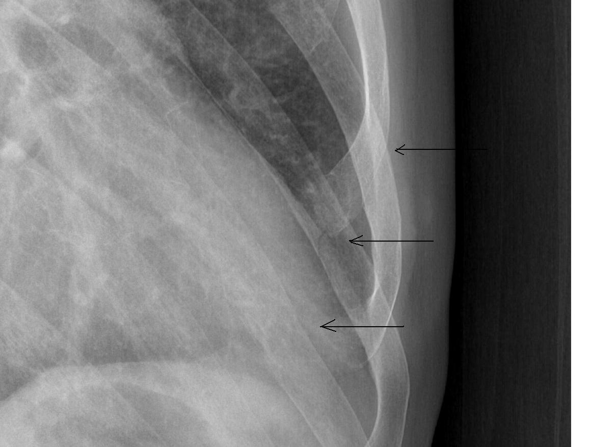 chest-1.JPG