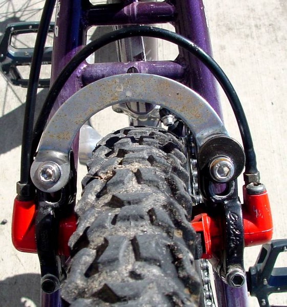 magura_u-brake.jpg