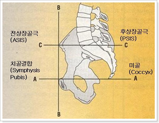 전상장골극.jpg